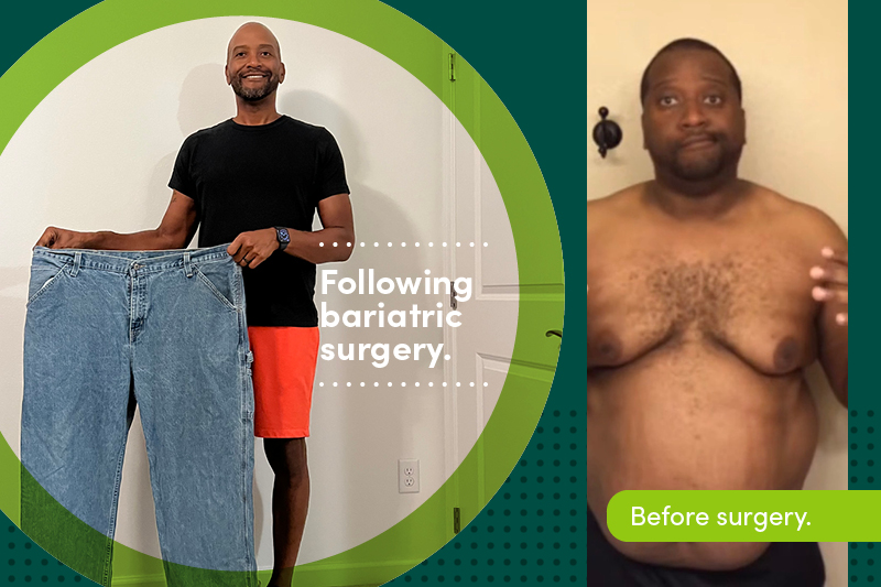 Byron Moore before and after bariatric surgery